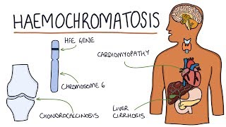 Understanding Haemochromatosis [upl. by Azriel416]