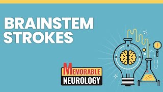 Brainstem Stroke Mnemonics Memorable Neurology Lecture 15 [upl. by Onfroi]