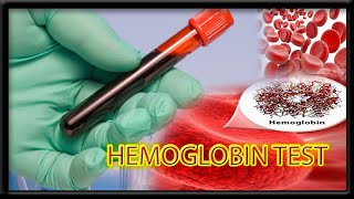 Hemoglobin Blood test  HGP   Harib diagnostic lab [upl. by Ilecara266]