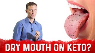 Why Dry Mouth On Keto Cotton Mouth – Dr Berg On Xerostomia amp Dry Mouth Causes [upl. by Buehler]